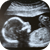 Ultrasound of fetus in utero