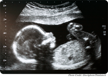 Ultrasound of fetus in utero