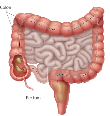 Large intestine picture has to be here