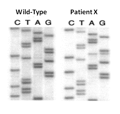 DNA sample from Patient X, side-by-side with Wild-Type DNA sample