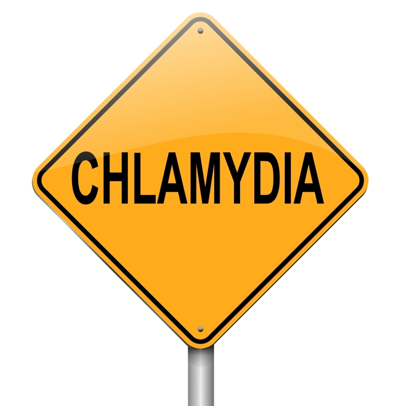 A yellow-colored sign with word CHLAMYDIA written on it.