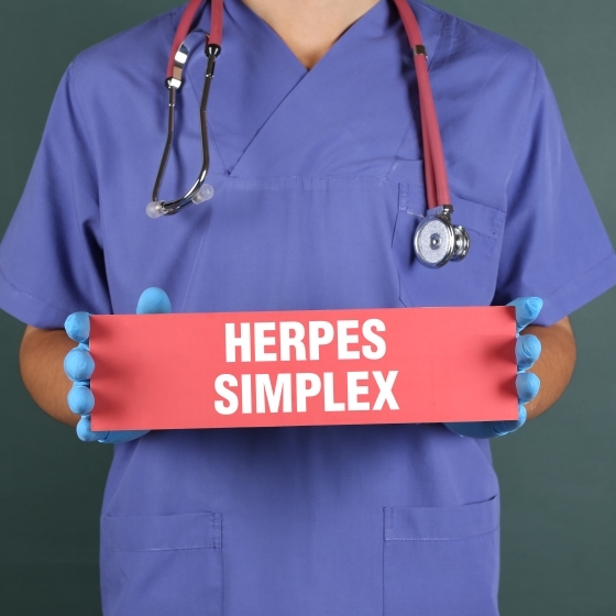 A doctor holds a board with the words Herpes Simplex printed on it.