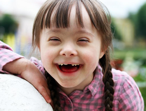 A small girl with down's syndrome laughs.