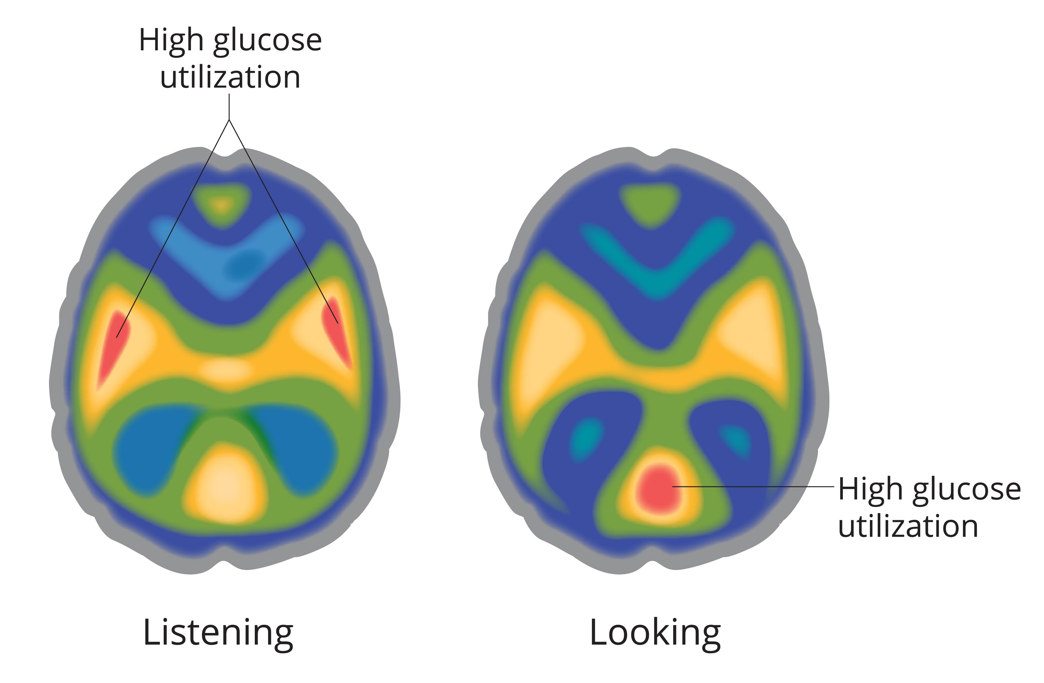 There are images of two PET scans of the brain. The first scan has high glucose utilization on the sides of the brain in the temporal lobes.  This is noticeable by the red areas on the scan and demonstrates that someone is listening.  The second scan has high glucose utilization at the back of the brain in the occipital lobe.  This is noticeable by the red area on the scan and demonstrates that someone is looking.  The areas with low glucose utilization in the brain are green and blue.