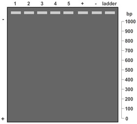 Gel Electrophoresis Graph