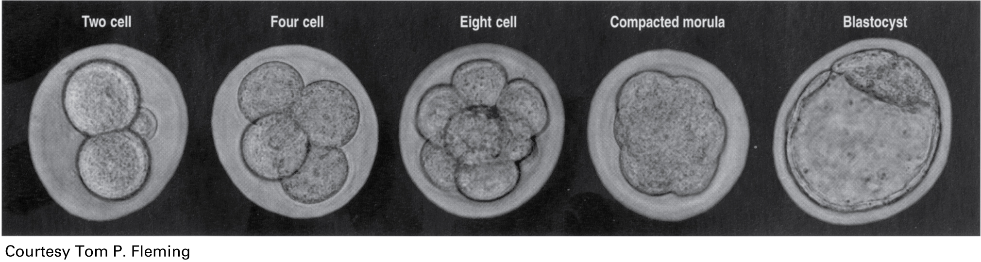 Figure 21-3. Cleavage divisions in the mouse embryo. Embryos are shown at the five stages: two cell, four cell, eight cell, compacted morula, and blastocyst. There is little cell growth during these early divisions, so that the cells become progressively smaller.