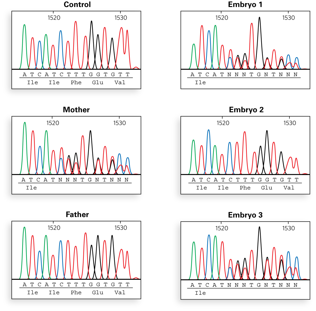 Sequencing chromatograms show the following results: Control sample: All tall, single peaks, ATCATCTTTGGTGTT, encoding amino acids Ile Ile Phe Glu Val Mother sample: Five tall, single peaks, followed by three shorter, overlapping peaks, then two tall single peaks, and five more shorter overlapping peaks, ATCATNNNTGNTNNN, encoding amino acid Ile and four unreadable amino acids Father sample: All tall, single peaks, ATCATCTTTGGTGTT, encoding amino acids Ile Ile Phe Glu Val Embryo 1 sample: Five tall, single peaks, followed by three shorter, overlapping peaks, then two tall single peaks, and five more shorter overlapping peaks, ATCATNNNTGNTNNN, encoding amino acid Ile and four unreadable amino acids Embryo 2 sample: All tall, single peaks, ATCATCTTTGGTGTT, encoding amino acids Ile Ile Phe Glu Val Embryo 3 sample: Five tall, single peaks, followed by three shorter, overlapping peaks, then two tall single peaks, and five more shorter overlapping peaks, ATCATNNNTGNTNNN, encoding amino acid Ile and four unreadable amino acids