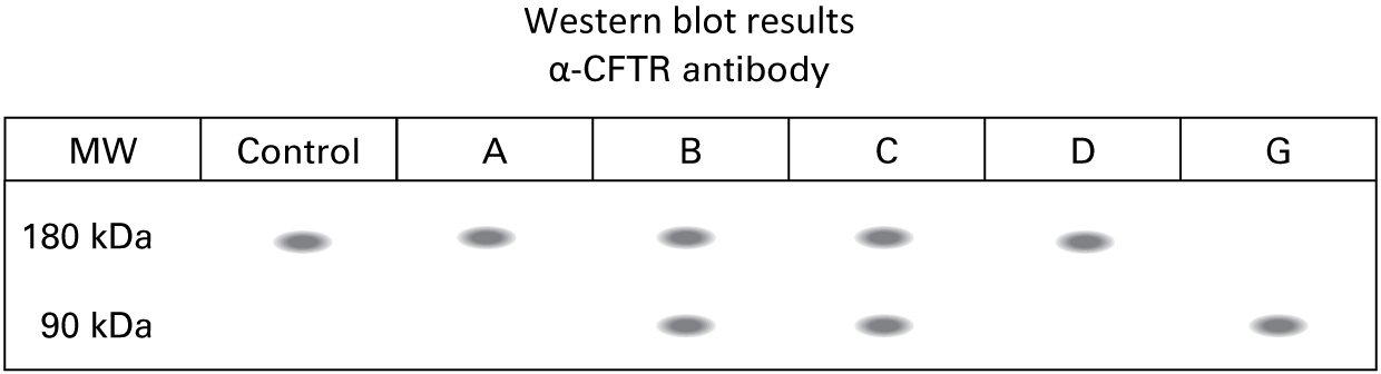 Western blot using the anti-CFTR antibody shows the following lanes and bands: Control sample: 180 kDa band Sample A: 180 kDa band Sample B: 180 kDa band, 90 kDa band Sample C: 180 kDa band, 90 kDa band Sample D: 180 kDa band Sample G: 90 kDa band 