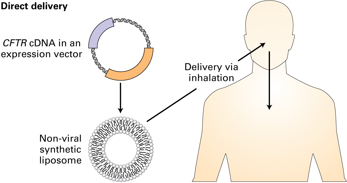 Diagram of direct delivery system. CFTR cDNA in an expression vector is inserted into a nonviral synthetic liposome, which is delivered to the patient through inhalation.