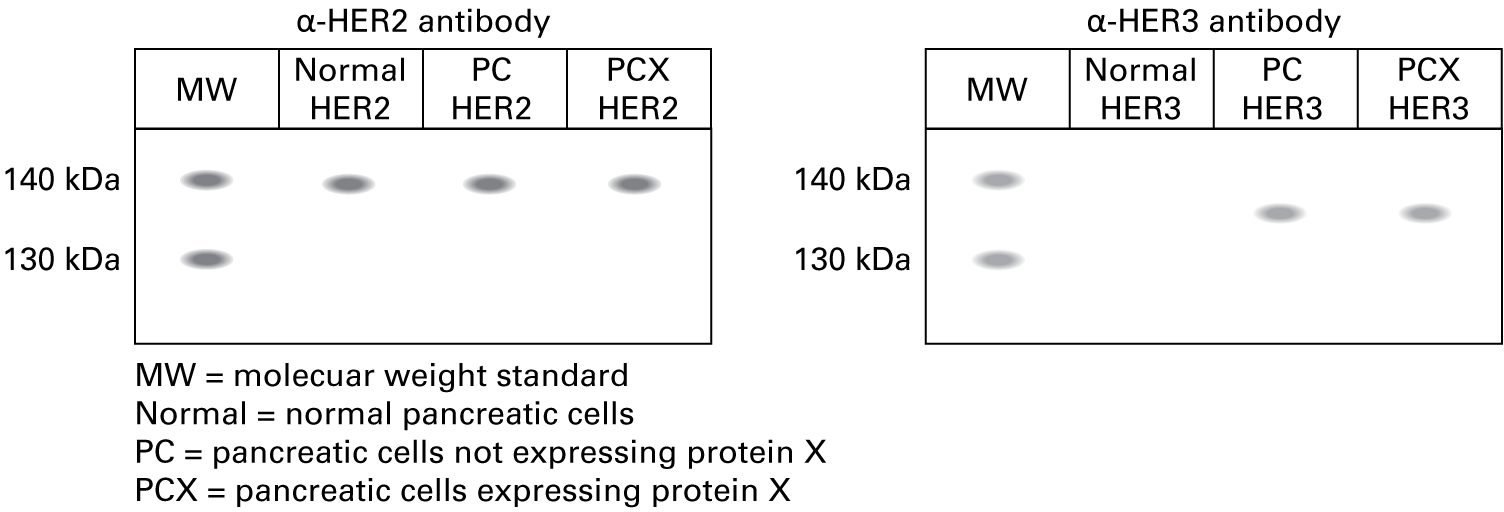Western blot using the anti-HER2 antibody shows the following lanes and bands: Normal pancreatic cells: band approximately 138 kDa Pancreatic cells not expressing protein X: band approximately 138 kDa Pancreatic cells expressing protein X: band approximately 138 kDa Western blot using the anti-HER3 antibody shows the following lanes and bands: Normal pancreatic cells: band approximately 135 kDa Pancreatic cells not expressing protein X: band approximately 135 kDa Pancreatic cells expressing protein X: band approximately 135 kDa 