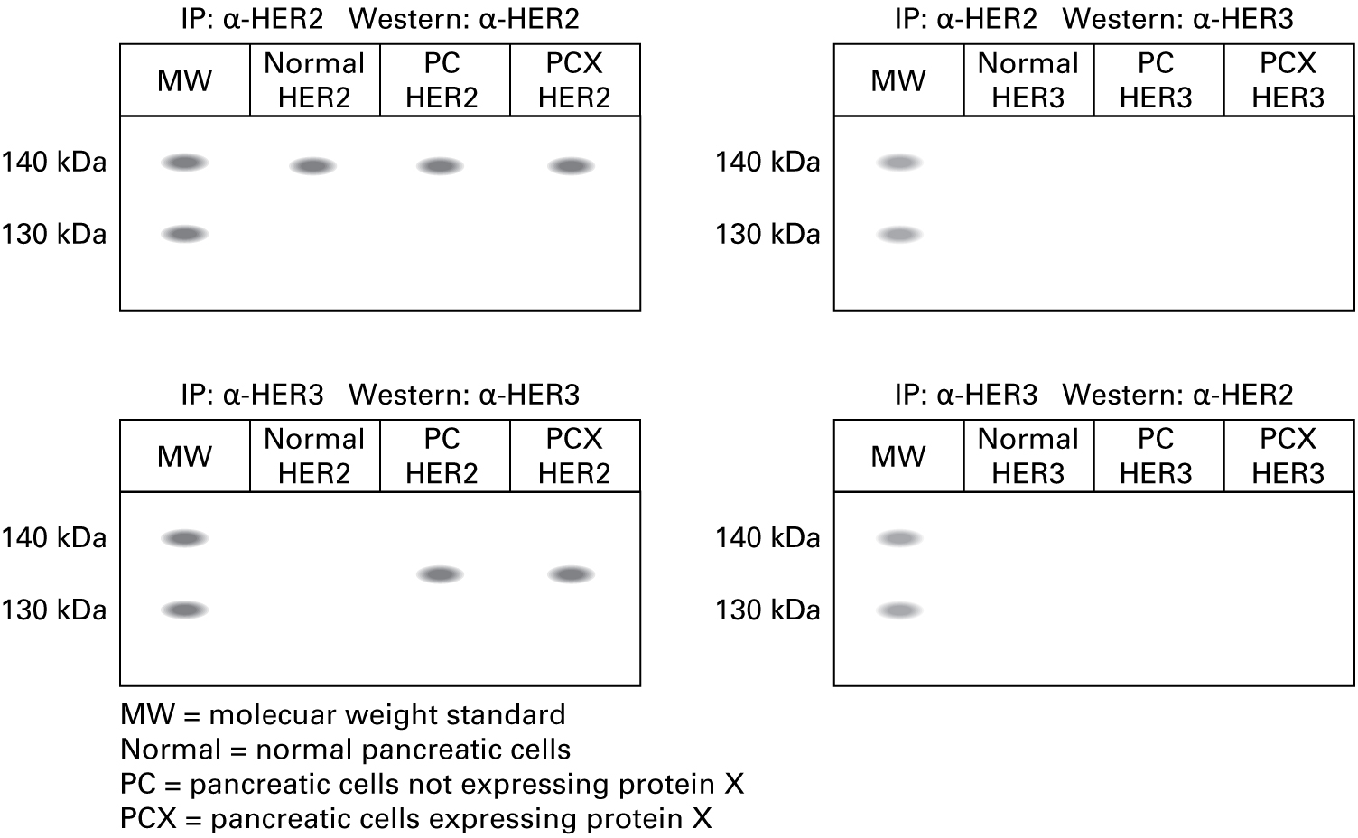 Immunoprecipitation using the anti-HER2 antibody, followed by Western blot using the anti-HER2 antibody shows the following lanes and bands: Normal pancreatic cells: band approximately 138 kDa Pancreatic cells not expressing protein X: band approximately 138 kDa Pancreatic cells expressing protein X: band approximately 138 kDa Immunoprecipitation using the anti-HER2 antibody, followed by Western blot using the anti-HER3 antibody shows the following lanes and bands: Normal pancreatic cells: no band  Pancreatic cells not expressing protein X: no band Pancreatic cells expressing protein X: no band  Immunoprecipitation using the anti-HER3 antibody, followed by Western blot using the anti-HER3 antibody shows the following lanes and bands: Normal pancreatic cells: band approximately 135 kDa Pancreatic cells not expressing protein X: band approximately 135 kDa Pancreatic cells expressing protein X: band approximately 135 kDa Immunoprecipitation using the anti-HER3 antibody, followed by Western blot using the anti-HER2 antibody shows the following lanes and bands: Normal pancreatic cells: no band  Pancreatic cells not expressing protein X: no band  Pancreatic cells expressing protein X: no band  