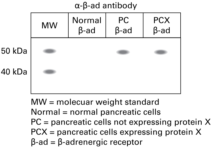 Western blot using the anti-β-adrenergic receptor antibody shows the following lanes and bands: Normal pancreatic cells: no band Pancreatic cells not expressing protein X: band approximately 48 kDa Pancreatic cells expressing protein X: band approximately 48 kDa 