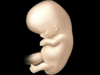 Fetus with large head and body, and recognizable arms and legs.