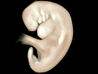 Embryo with small arm and leg buds, larger torso than head, and large tail.