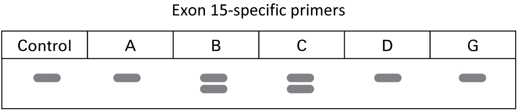 PCR results using exon 15-specific primers show the following lanes and bands: Control sample: one band Sample A: one band Sample B: two bands Sample C: two bands Sample D: one band Sample G: one band 