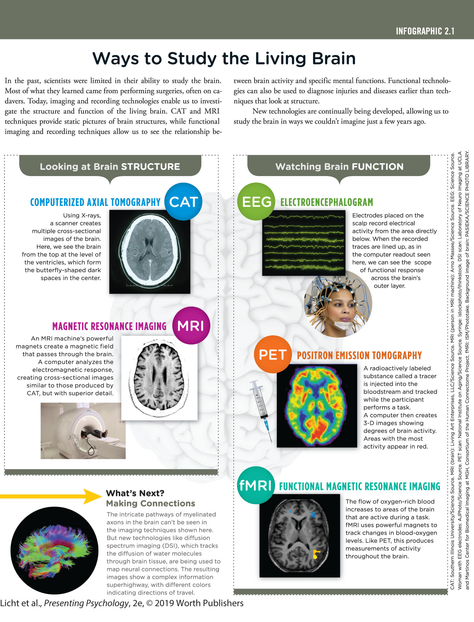 An infographic titled, Ways to Study the Living Brain, explains the various divisions in brain structure and brain functions. You can read full description from the link below
