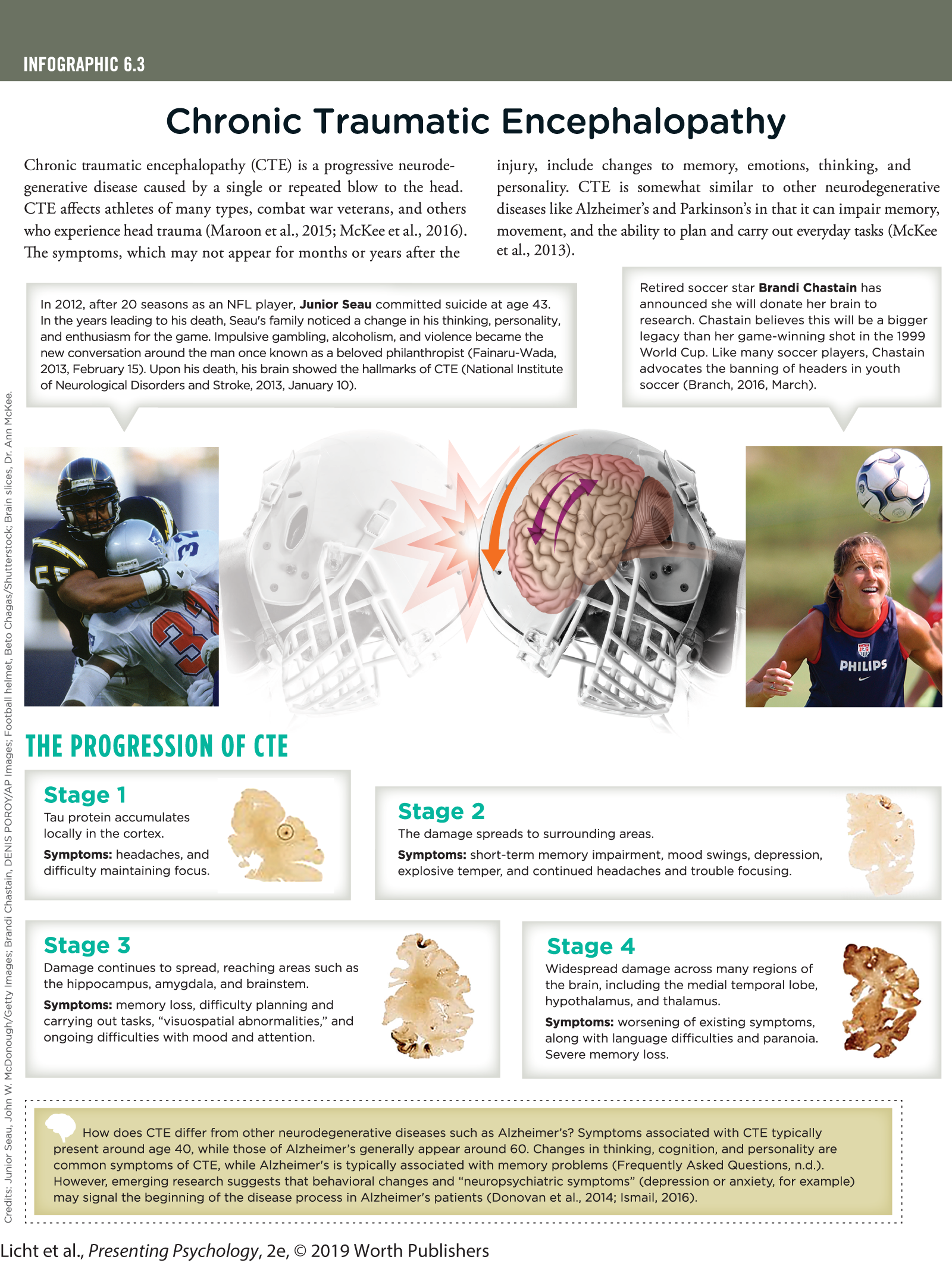 An infographic titled, Chronic Traumatic Encephalopathy shows the stages involved in the progression of CTE. You can read full description from the link below